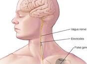 What Vagus Nerve Stimulate
