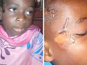 Little Severely Abused, Beaten Left N*ked Bush Akwa Ibom (Photos)