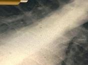 X-ray Popular Medical Imaging Technology Used Diagnose Wide Range Disease.