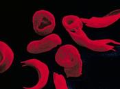 Global Hemoglobinopathy Market Europe Estimated Dominant Regional 2019 2027