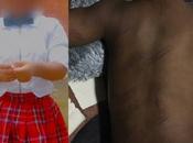 Lagos State Govt Seals School Where 2-year-old Allegedly Flogged Mercilessly Teacher