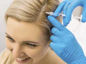 Androgenetic Alopecia Treatment Market Rapidly Increasing Growth Latest Report With Future Estimations, Current Trends Opportunity Analysis 2020-2027