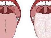 Candidiasis Market Global Industry Analysis, Size, Share, Growth, Trends, Forecast, 2018–2026