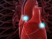Implantable Cardioverter-defibrillators Market Product Type, Patient Users, Region Global Forecast 2026
