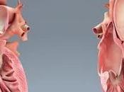 Myocardial Infarction Market Global Industry Analysis, Size, Share, Growth, Trends Forecast 2015 2023