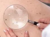 Melanoma Treatment Market Global Industry Insights, Trends, Outlook, Opportunity Analysis, 2018 2026