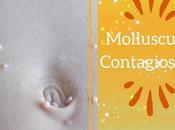 Treatment Molluscum Contagiosum