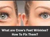 Crows Feet, They Form Them?