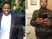 Long Term Weight Loss Success Markel’s Band Journey