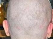Would Shave Your Head?