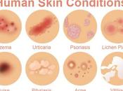 Skin Conditions: Treat Them, What They Mean When Seek Professional Help!
