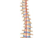 Postural Dysfunction Scoliosis