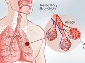 Lung Cancer Symptoms