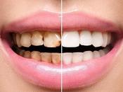 Disadvantage Excessive Tooth Scaling Ayurveda Help