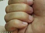 Midwife’s Gold Chain Stolen While Cooking Home