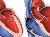 Dilated Cardiomyopathy Disorder That Leads Heart Muscle Weaken Enlarge