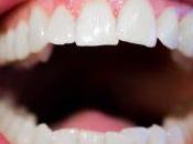 Will Things Change Approach Best Dental Implants Aberdeen?