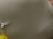 Natural Remedies Snoring: Simple Solutions Silent Nights