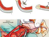 Peyronie's Disease Treatment Market: Rising Demand Non-Surgical Therapies