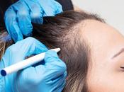 Hair Loss Treatment Market: Overview Current Solutions Future Prospects