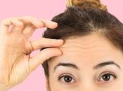 Make Your Forehead Smaller Naturally: Ways