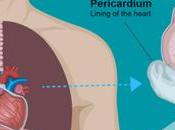 What Mesothelioma Navy Testicular Advice 2023