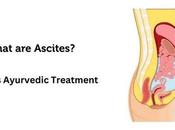 Ascites Causes, Symptoms, Ayurvedic Treatment