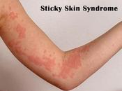 Alternative Treatment Sticky Skin Syndrome With Herbal Remedies