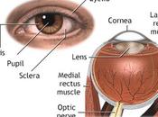 Herbal Remedies Optic Neuritis