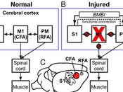 Neural Prosthesis Restore Sensory-motor Function After Brain Damage.