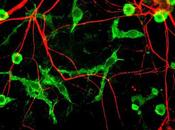 Harnessing Brain’s Immune Cells Stave Alzheimer’s Other Neurodegenerative Diseases
