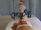 Just Started Panic’: Flight Attendant Gets Payout After Turbulence Broke Seven Places