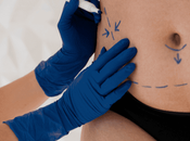 Myths About Lipo Laser Therapy Debunked