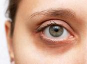 Most People Right-Handed, Left-Eyed