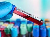 Blood Test Beats Doctors Early Diagnosis Alzheimer’s Disease