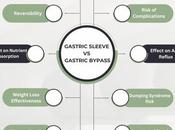 Gastric Sleeve Bypass: Comparing Effective Weight Loss Surgery Options