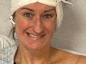 Groundbreaking Hologram Surgery Helps Scottish Woman Avoid Facial Paralysis