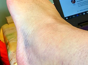 Teen Suicide Still Rise