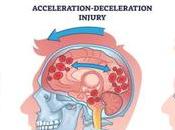 Living With Post-Concussion Syndrome Navigating Recovery