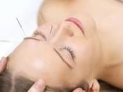Things Really Need Know About Acupuncture