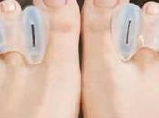 Minimalist Miracle? Correct Toes Treat Cure Foot Pain Without Surgery