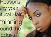 Reasons Your Natural Hair Thinning Around Edges