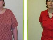 Bariatric Surgery Your Journey Successful Weight Loss