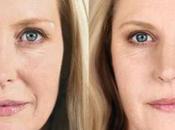 Learn Everything About Collagen Injections