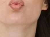Dark Spots Lips Naturally Fast: Tips