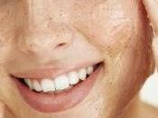 Best Home Remedies Pimples