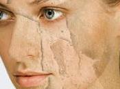 Best Home Remedies Cure Peeling Skin Face Hands