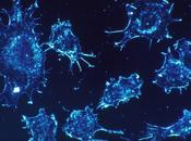 Nano Bubbles Successfully Kill Cancer Cells
