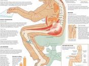 Dangers Sitting Posture Avoid Them Inforgraphic