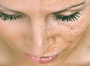 Most Common Home Remedies Reduce Black Spots Your Face